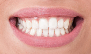 Close-up of a person’s smile