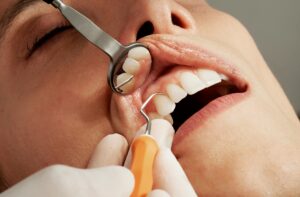 Dental Implants and Chronic Conditions (Diabetes/Osteoporosis)