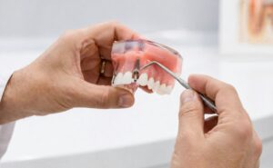 Does Insurance Cover Dental Implants?